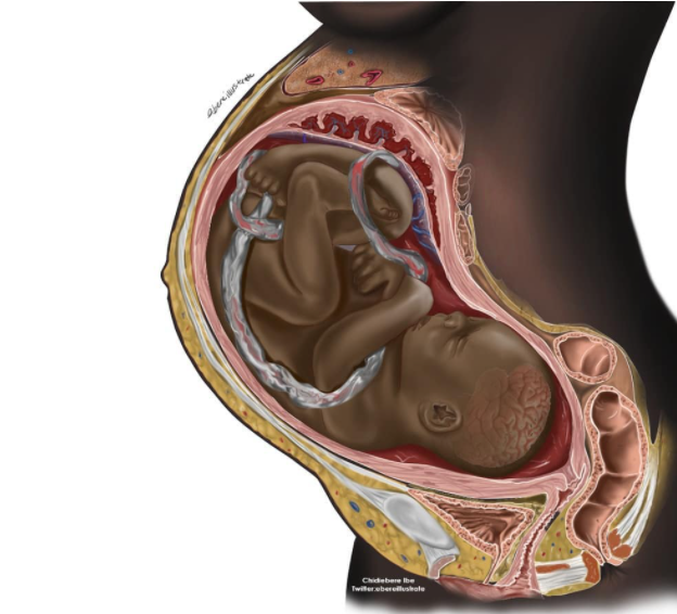 Black-Fetus In Womb Image
